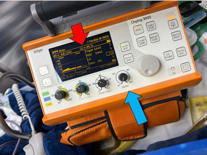 Ventilador portátil Oxylog 3000 empleado para soporte respiratorio y transporte crítico. Imagen del autor